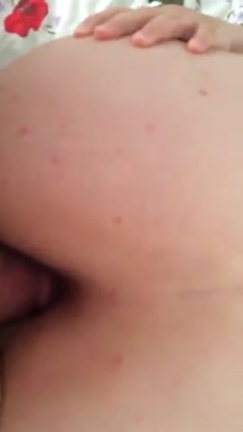 这逼长了这么多红疹居然还敢无套干